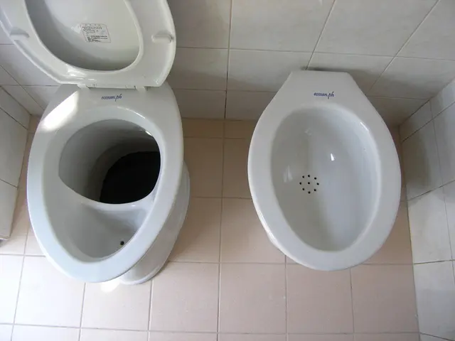 Cleansing Toilet: Eliminating Excessive Urine Buildup in Toilet Bowls